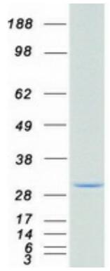 Coomassie blue staining of purified LGALS3 protein.
